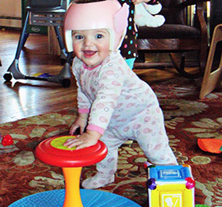 For mild plagiocephaly (flat head), you wore a bright pink football helmet…
